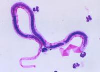 Gene mutations that increase risk of a kidney disease may have evolved to protect against helminth worm infection.